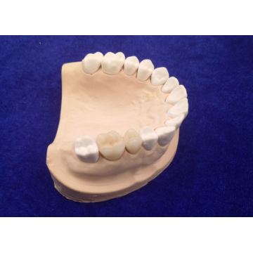 Cobalt Chromium Alloy ceramic teeth